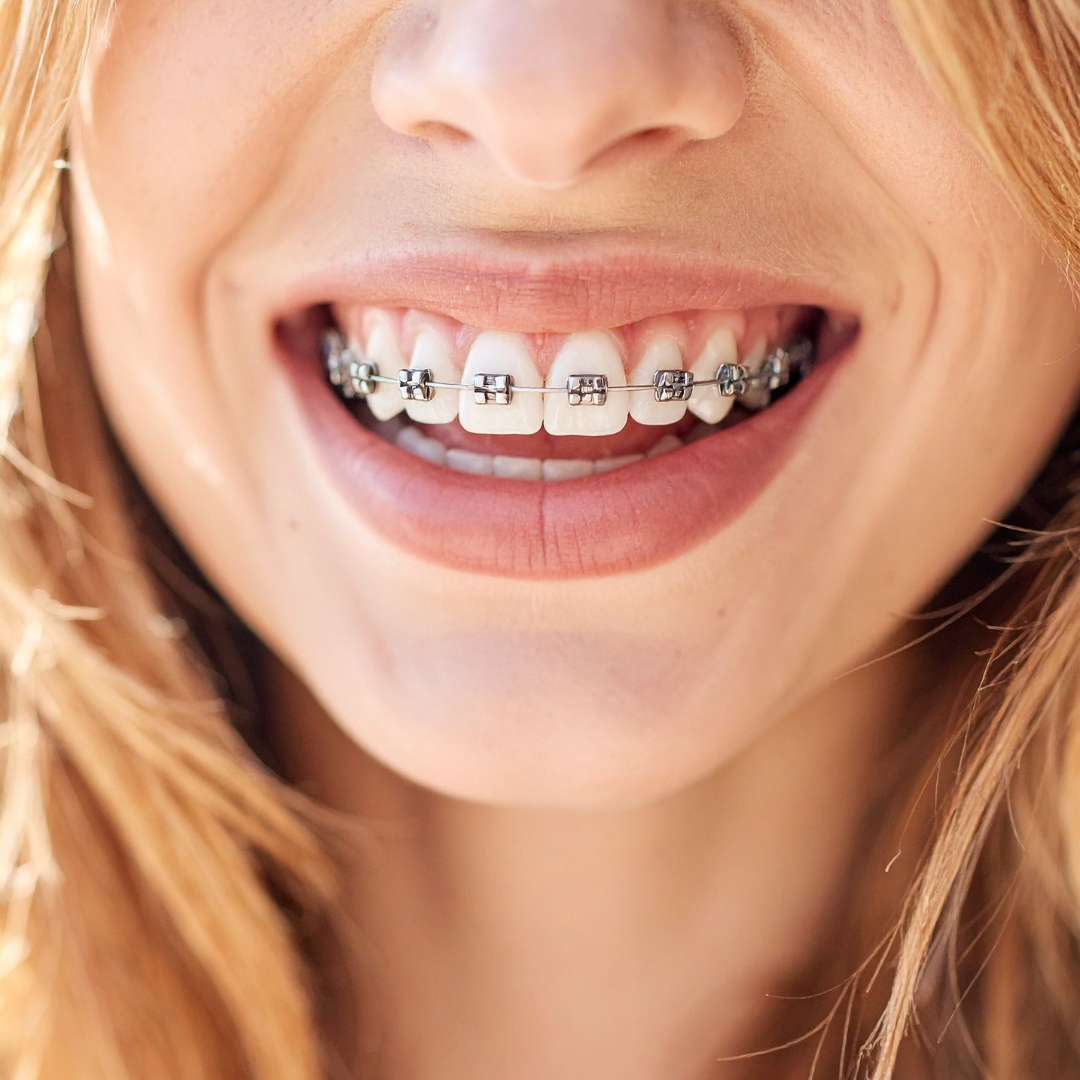 Orthodontics